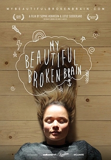 "My Beautiful Broken Brain" (2014) WEBRip.x264-TinyE